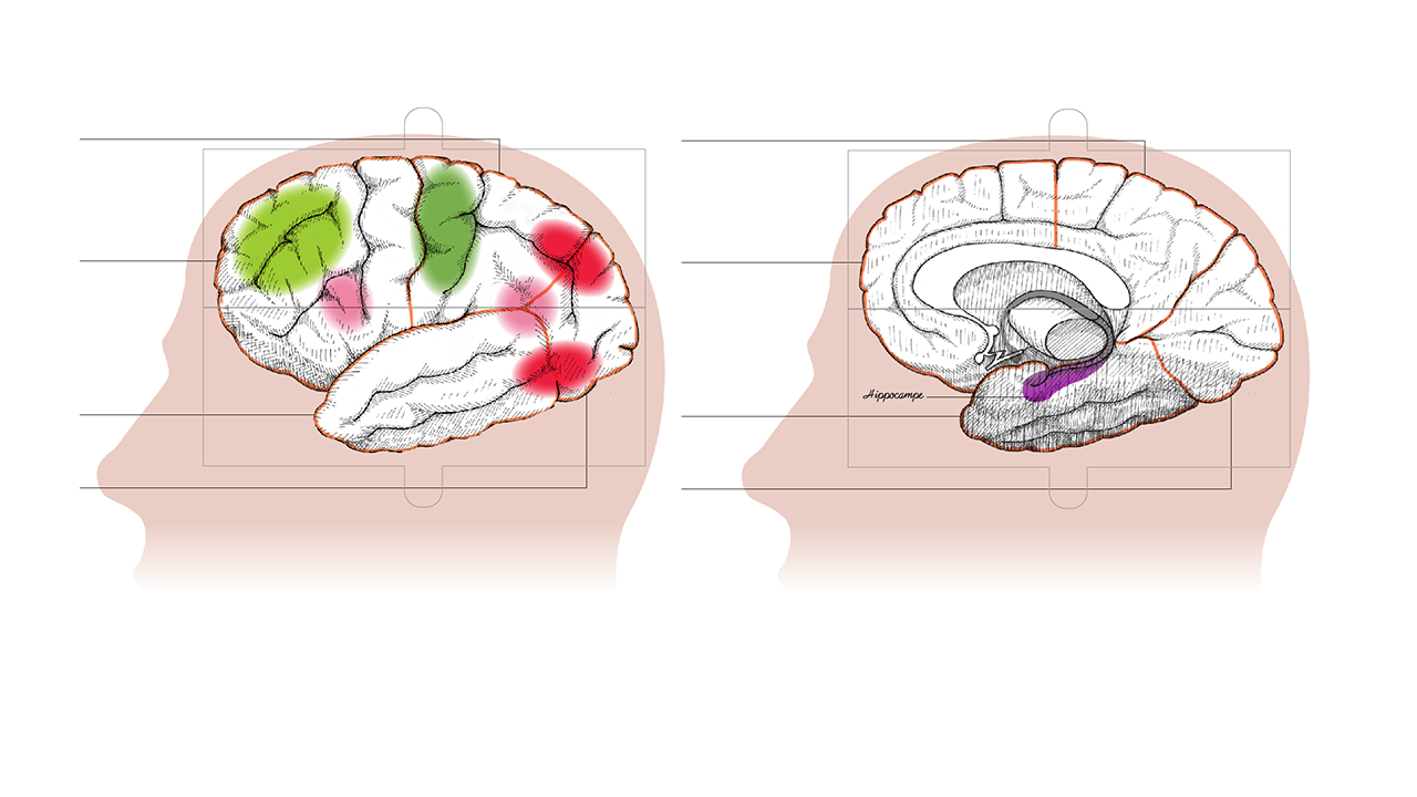 Image - abecedaireneuro07