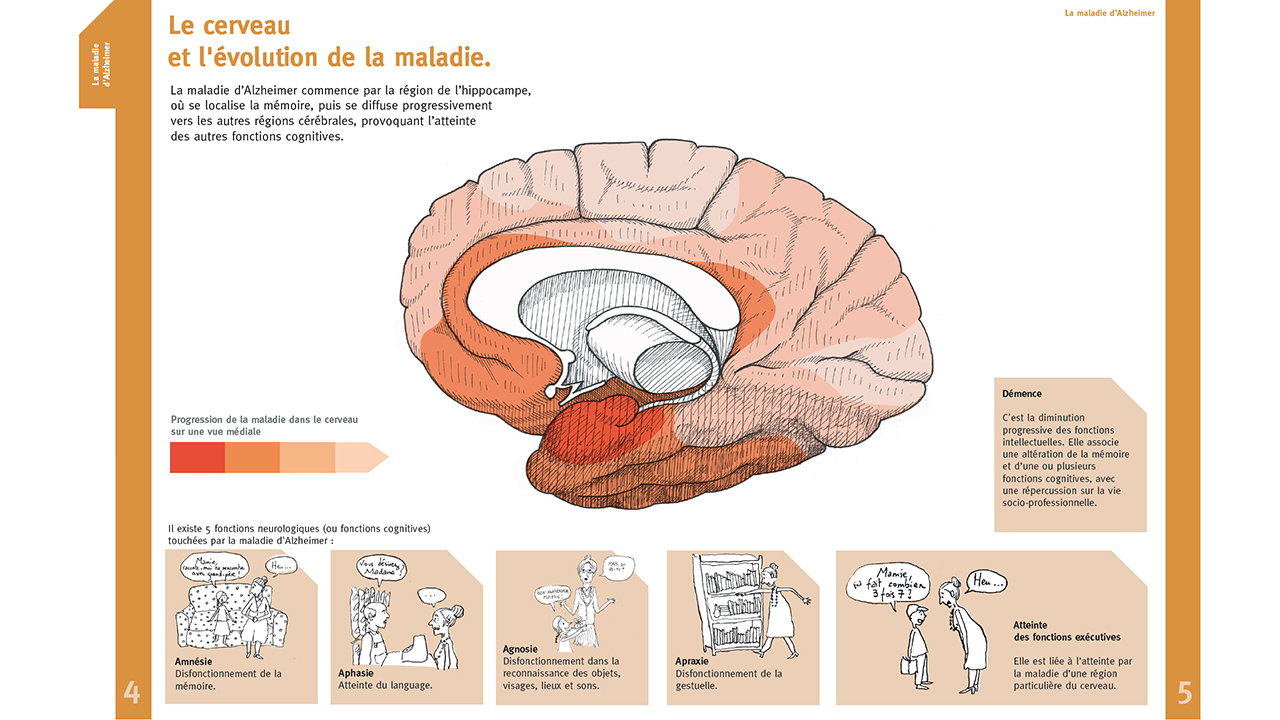 Image - abecedaireneuro12