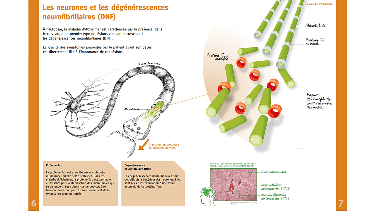 Image - abecedaireneuro13