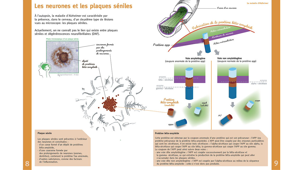 Image - abecedaireneuro14