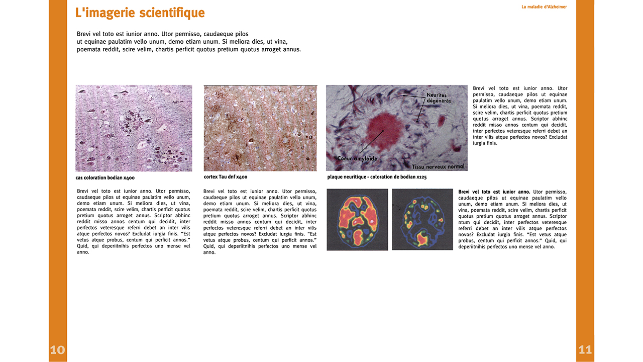 Image - abecedaireneuro15