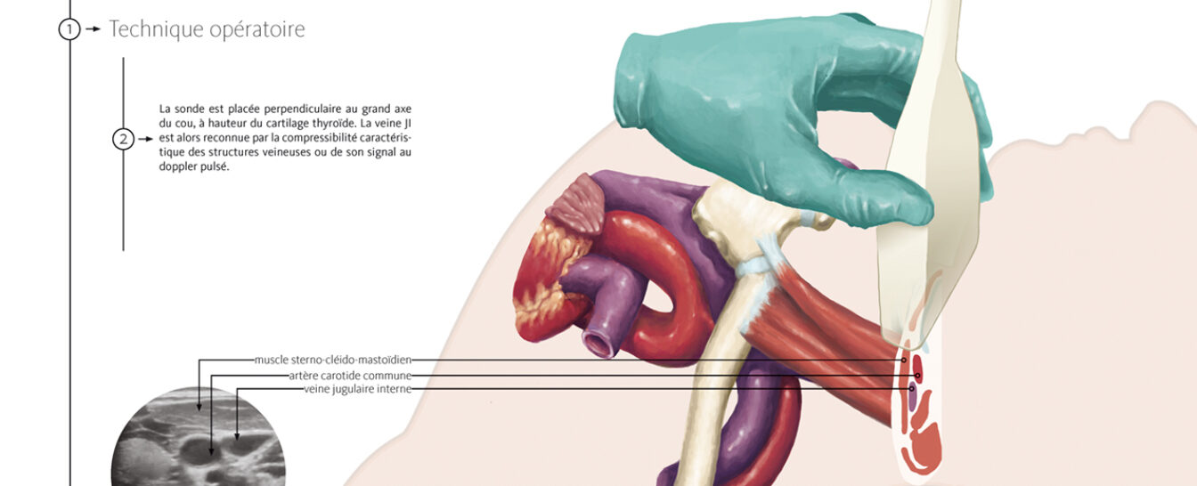 Image - Les trajets artériels et palpation du pouls