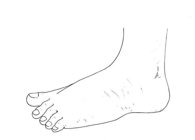 Image - Anatomie et pathologies du pied