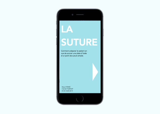 Image - La suture